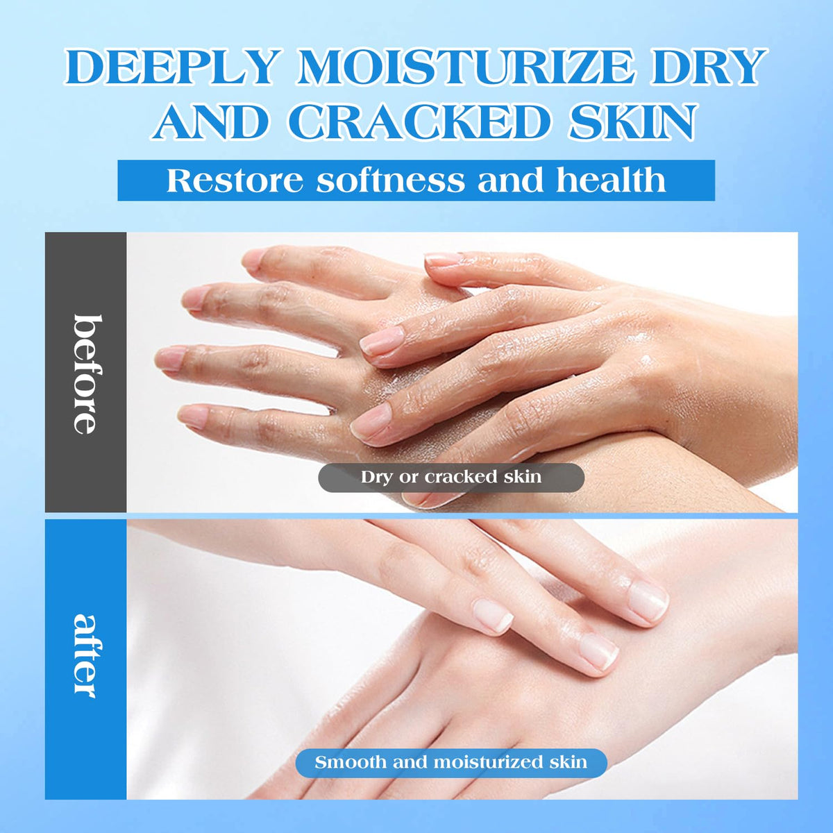 42% Urea Cream for Dry & Cracked Skin - Foot & Hand Cream with 2% Salicylic Acid, 5% Vitamin E, Tea Tree Oil, Aloe Vera, Shea Butter - Moisturizer & Skin Repair Cream for Feet Maximum Strength