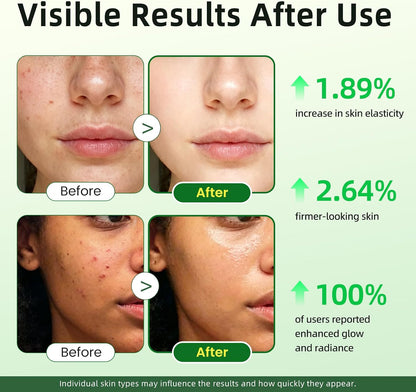 Lukaree Vitamin C Serum for Face, Dark Spots, Fine Lines & Support Collagen | Vitamin C Serum 20% Brightening Face Serum with Sodium Hyaluronate - All Skin Types, Plus Vit C Caps, 1 Fl Oz + 60 Caps