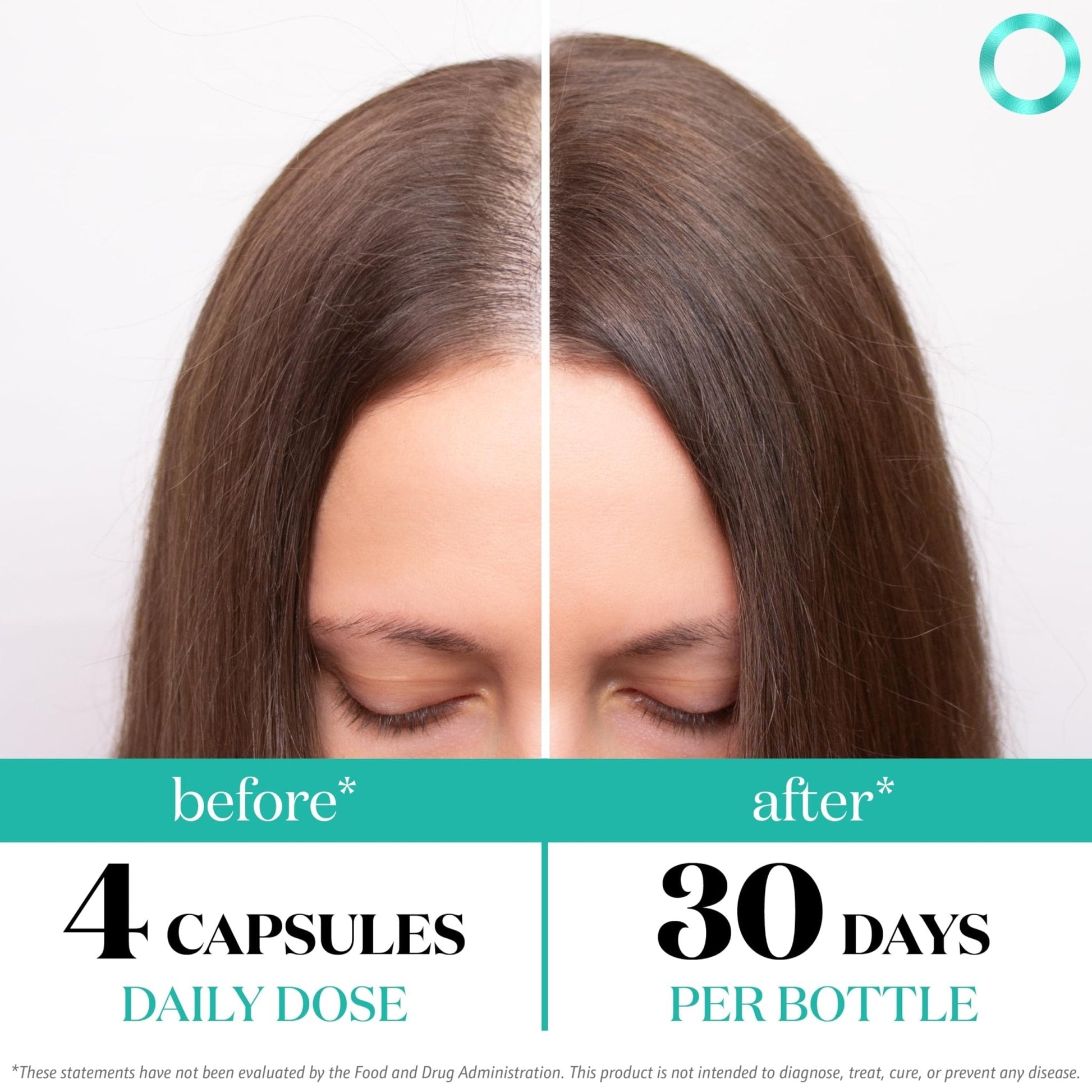 Women's Balance Hair Growth Supplements, Ages 45 and Up, Customer Proven for Visibly Thicker Hair and Scalp Coverage, Soy-Free, Made with 26 Ingredients including Beta Carotenes - 2 Month Supply - PrimeBioHealth - canada supplements